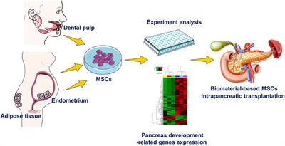 The Higher Inherent Therapeutic Potential of Biomaterial-Based hDPSCs and hEnSCs for Pancreas Diseases